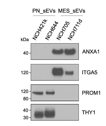 Open access visualization of Gel, Western Blots, Annexin A1, Integrin alpha-5, Prominin-1