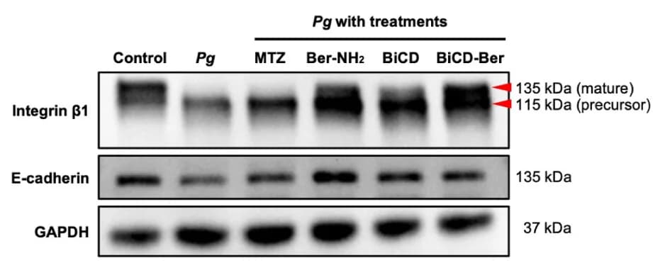Open access visualization of Gel, Western Blots, Integrin β1, E-cadherin, GAPDH