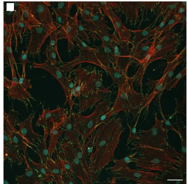 Open access visualization of Microscopy, HNDFs, f-actin, Nucleus, Focal Adhesions
