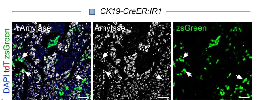 Open access visualization of Microscopy, Immunostaining, Pancreatic Sections, tdT, zsGreen