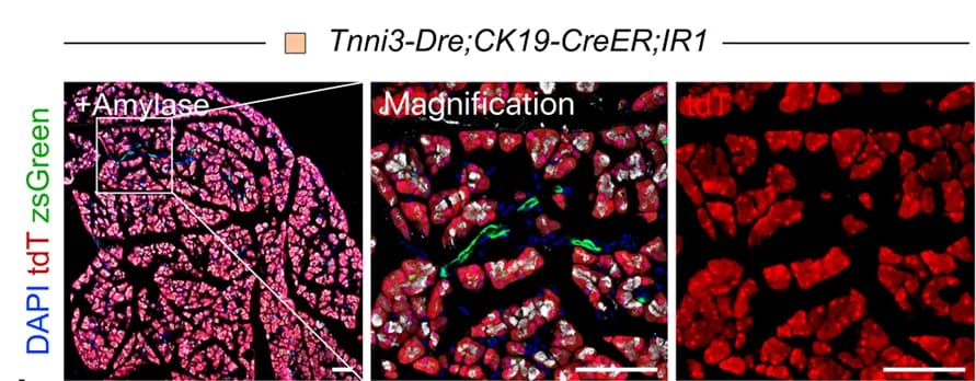 Open access visualization of Microscopy, Immunostaining, Pancreatic Sections, tdT, zsGreen