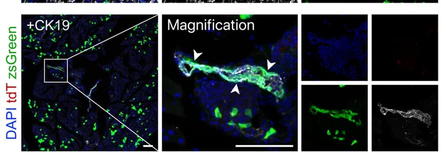 Open access visualization of Microscopy, Immunostaining, Pancreatic Sections, CK19, Ductal Cells
