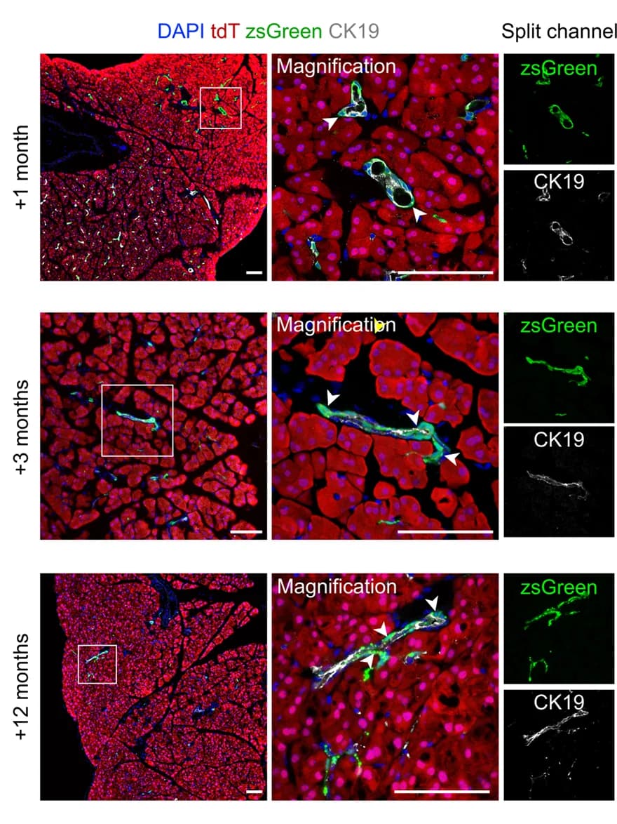Open access visualization of Microscopy, Immunostaining, tdT, zsGreen, CK19