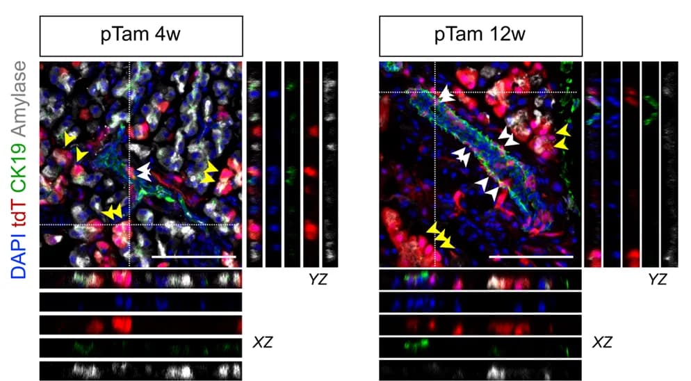 Open access visualization of Microscopy, Immunostaining, tdT, E-cad, CK19