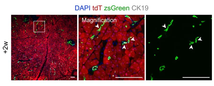 Open access visualization of Microscopy, Immunostaining, tdT, zsGreen, CK19
