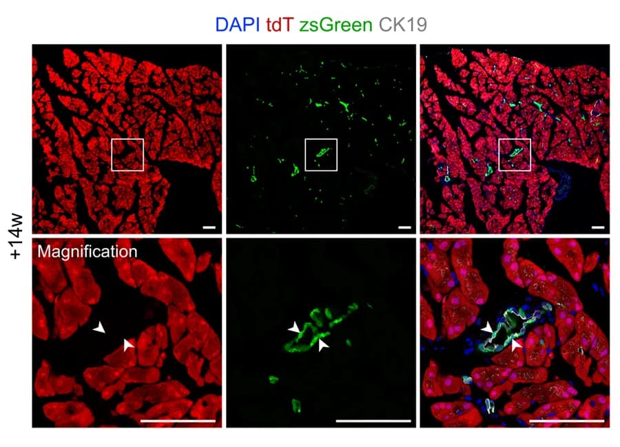 Open access visualization of Microscopy, Immunostaining, tdT, zsGreen, CK19