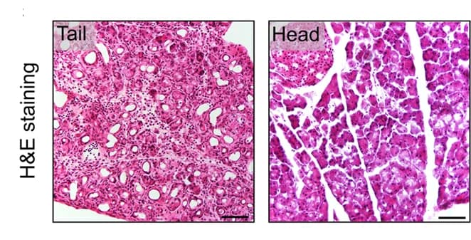 Open access visualization of Microscopy, H&E Staining, Pancreatic Sections, Mice