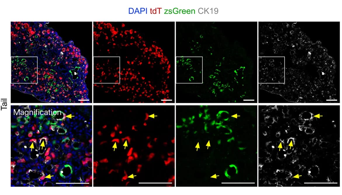 Open access visualization of Microscopy, Immunostaining, tdT, zsGreen, CK19