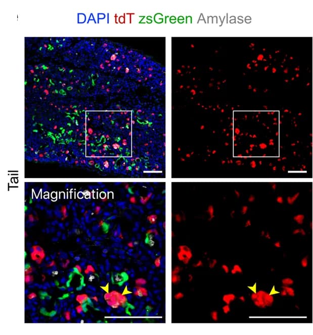 Open access visualization of Microscopy, Immunostaining, Amylase, Pancreas, Tail Region