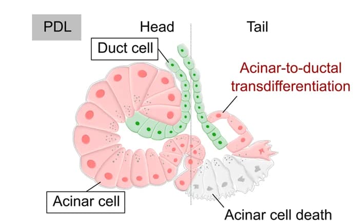Open access visualization of Illustration, Duct Cells, Acinar Cells, PDL, tdT