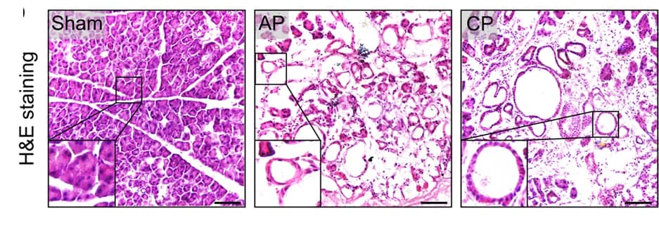 Open access visualization of Microscopy, H&E Staining, Pancreatic Sections, Mice