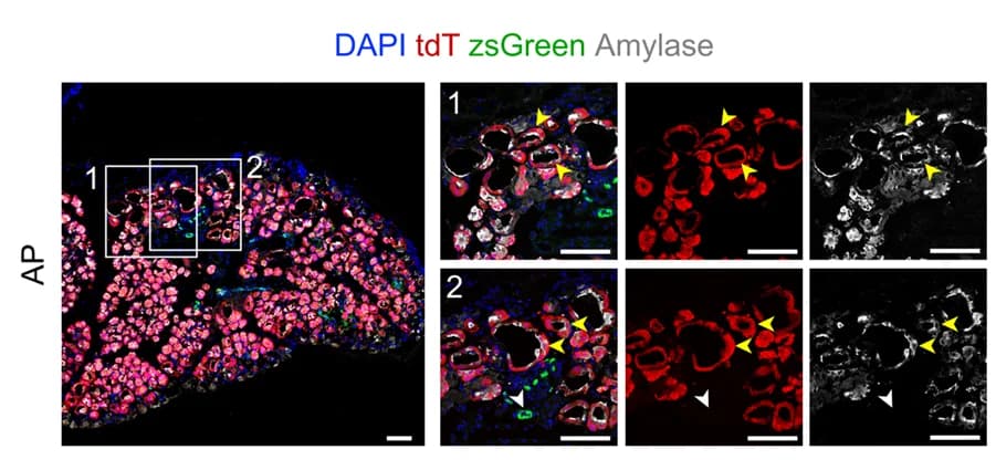 Open access visualization of Microscopy, Immunostaining, Amylase, Pancreatic Sections, Mice