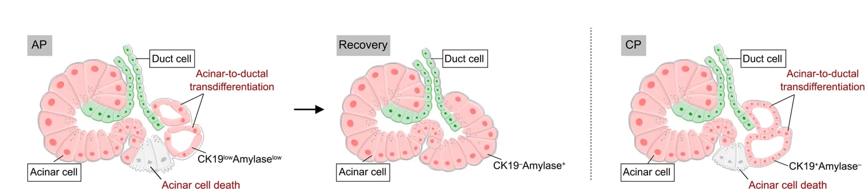 Open access visualization of Workflow, Illustration, Diagram, Ductal Cells, tdT + Acinar Cells