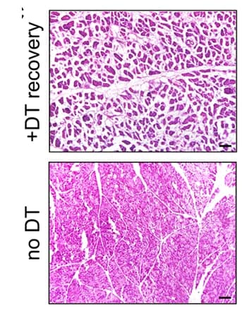 Open access visualization of Microscopy, H&E staining, Pancreatic sections, Mice