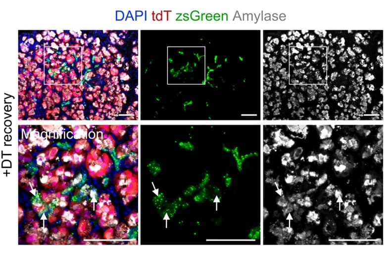 Open access visualization of Microscopy, Immunostaining, tdT, zsGreen, Amylase