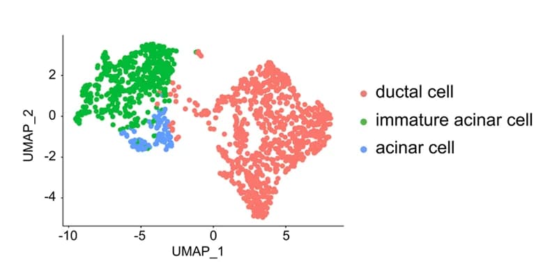 Open access visualization of Scatter Plot, UMAP, zsGreen, Epithelial Cells, Cell clusters
