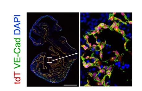 Open access visualization of Microscopy, Immunostaining, tdT, VE-Cad, DTR