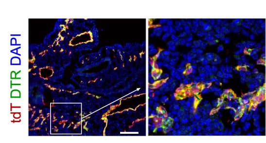 Open access visualization of Microscopy, Immunostaining, tdT, VE-Cad, DTR
