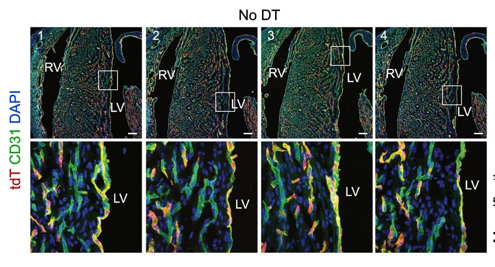 Open access visualization of Microscopy, Immunostaining, tdT, CD31, P5 heart sections