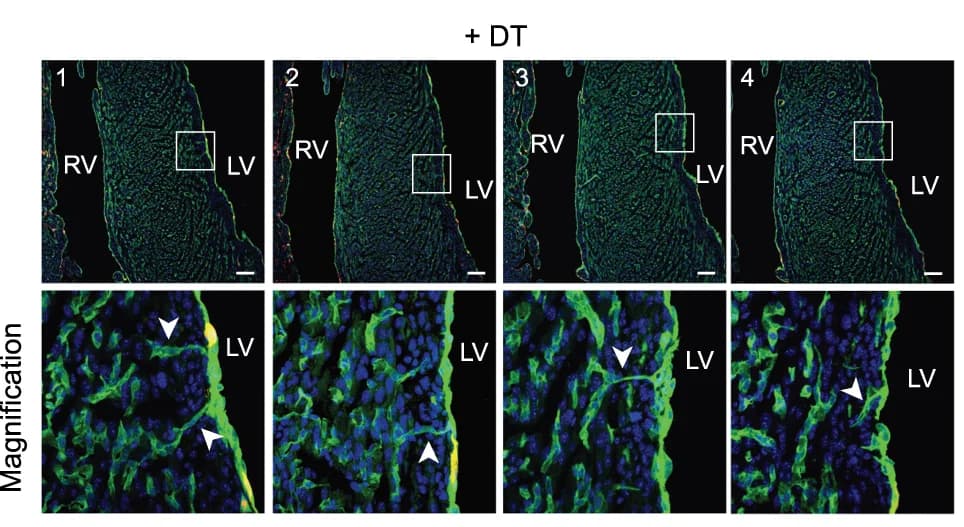 Open access visualization of Microscopy, Immunostaining, tdT, CD31, P5 heart sections