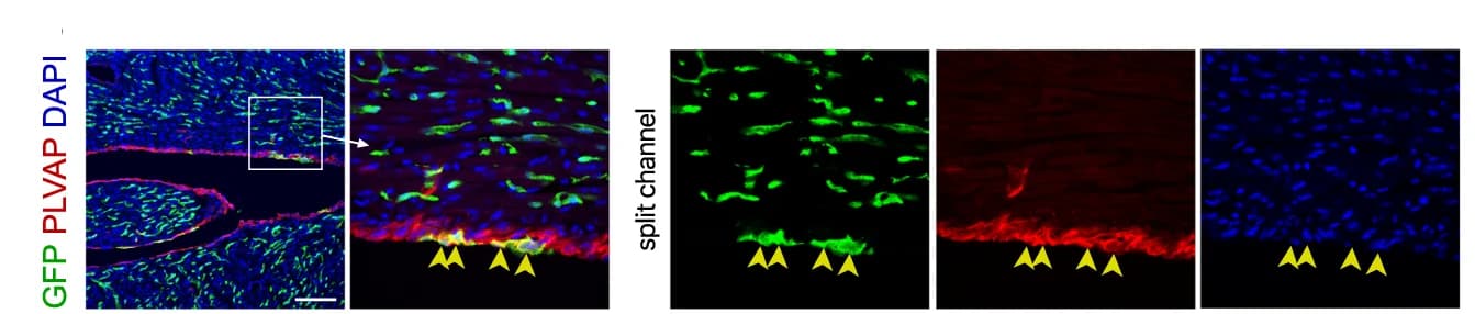 Open access visualization of Microscopy, Immunostaining, GFP, PLVAP, P14 heart sections