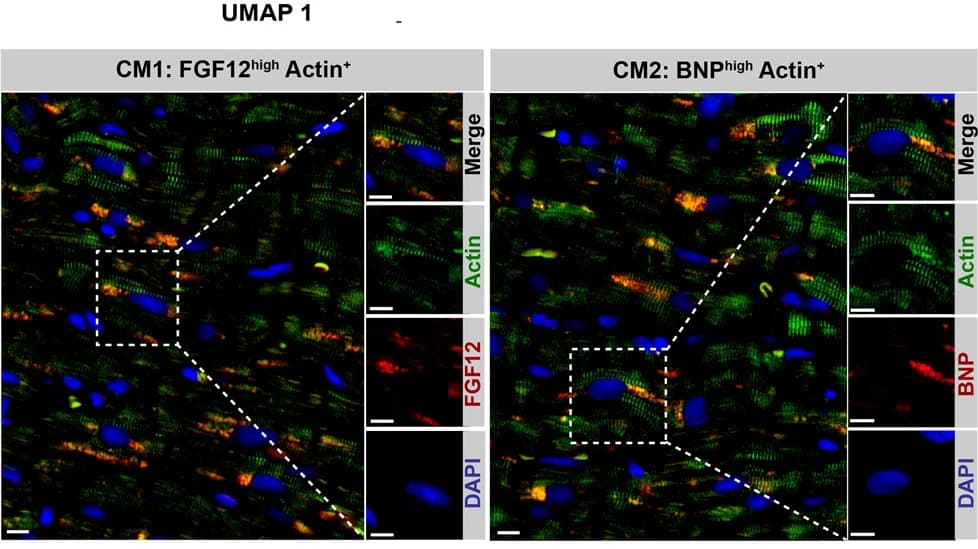 Open access visualization of Microscopy, Immunofluorescence Staining, Subpopulations, Cardiac Tissues, HCM Patients