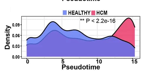 Open access visualization of Density Plot, Density Curves, Cardiomyocytes, Conditions, Trajectory