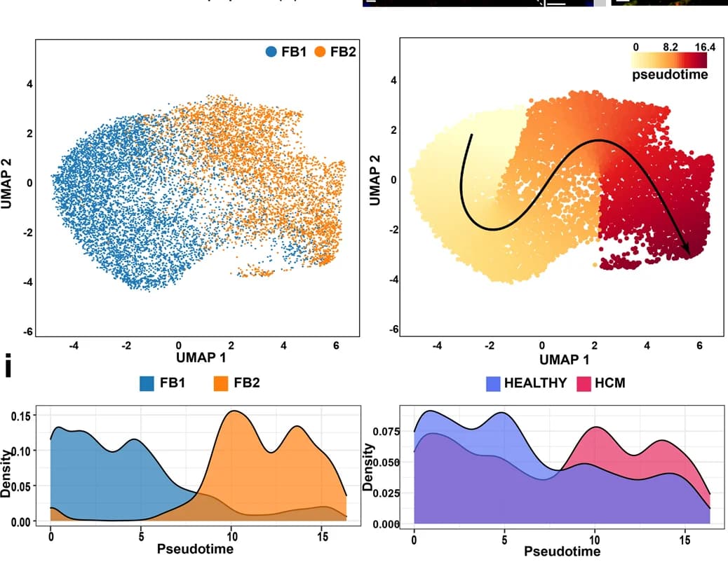 Open access visualization of UMAP, Scatter Plot, Density Plot, UMAP plot, Subpopulations