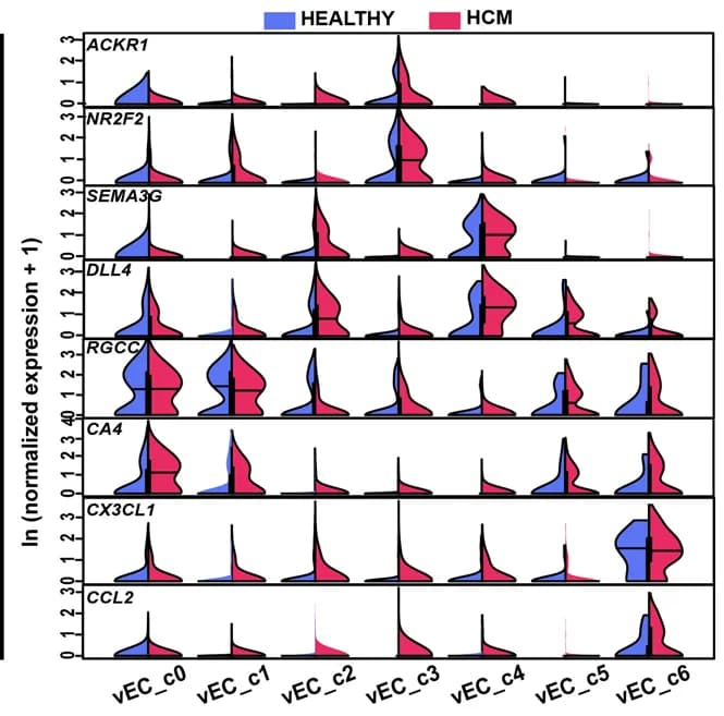 Open access visualization of Violin Plot, Venous Ecs, Arterial Ecs, Capillary Ecs, Immune Ecs