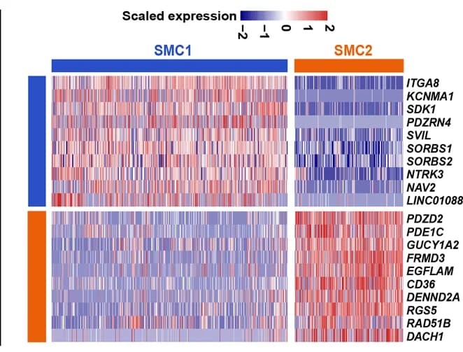 Open access visualization of Heatmap, Molecular signature, SMC subpopulation