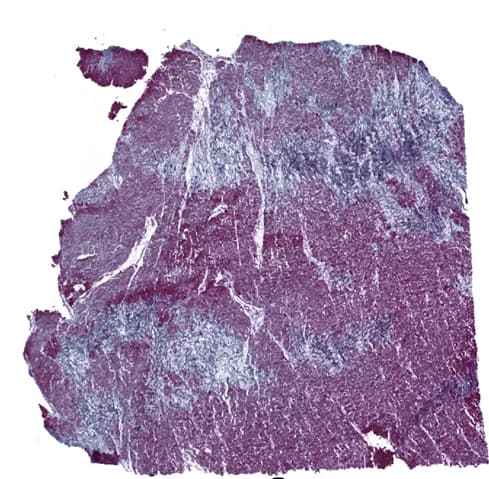 Open access visualization of Microscopy, Masson's Trichrome Staining