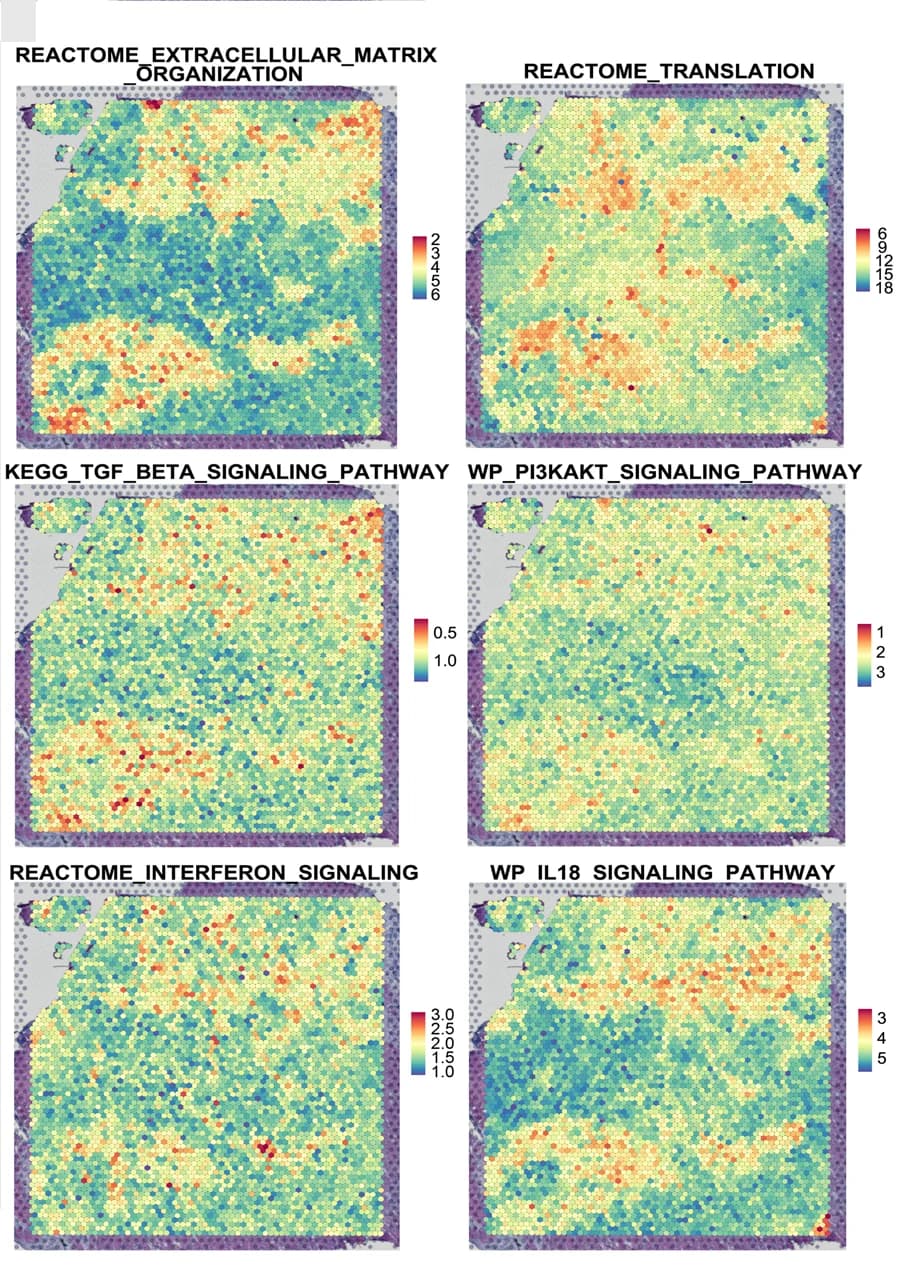 Open access visualization of Heatmap, Upregulated Pathways, Fibrotic Regions
