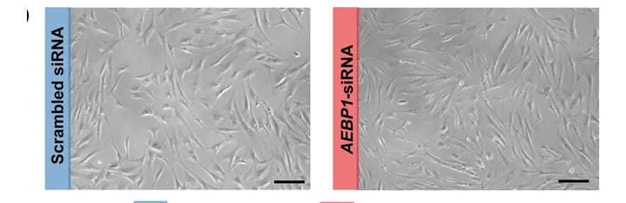 Open access visualization of Microscopy, Bright-field Images, Cardiac Fibroblasts, Transfection
