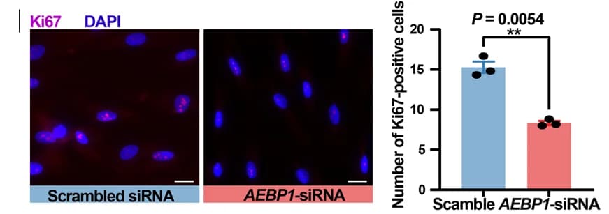 Open access visualization of Bar Plot, Error Bars, Ki67 Staining, AEBP1 Knockdown, Cell Proliferation