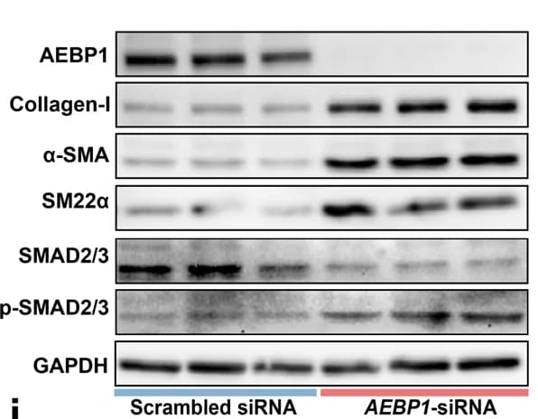 Open access visualization of Gel, Western Blot Assay, Protein Expression, AEBP1, Fibroblast Activation Markers