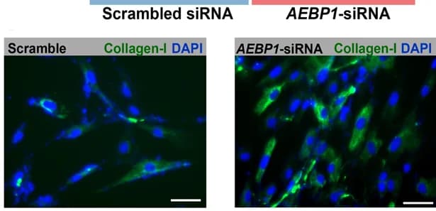 Open access visualization of Microscopy, Immunofluorescence Staining, Cultured Fibroblasts, Collagen-I, AEBP1 Knockdown
