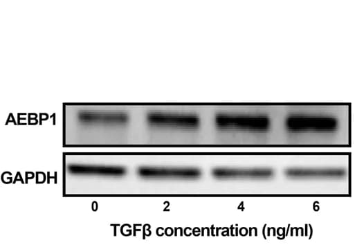 Open access visualization of Gel, Protein Level, Cardiac Fibroblasts, TGF Treatment, AEBP1