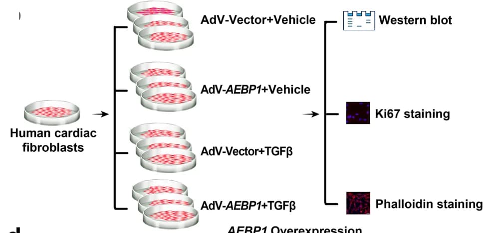 Open access visualization of Workflow, Photo, Gel, Experimental Design, AEBP1 Overexpression