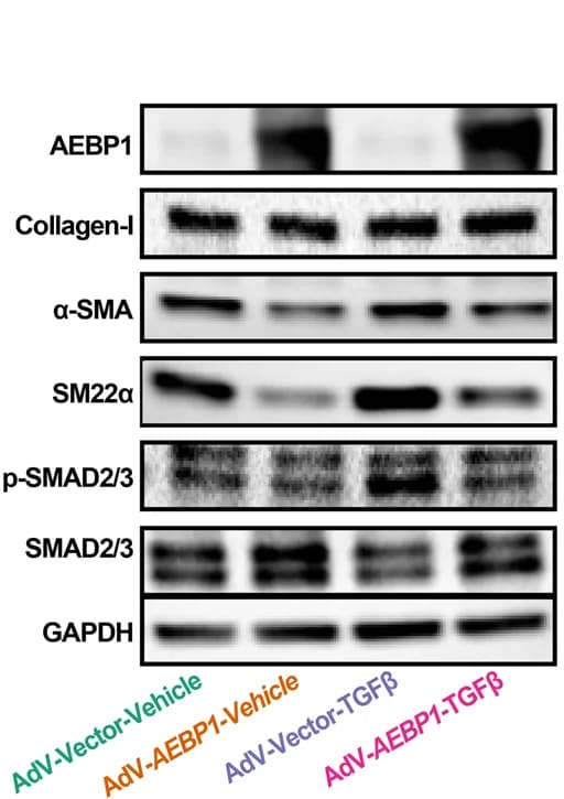 Open access visualization of Gel, Western Blot, Protein Expression, AEBP1, Fibroblast Activation Markers