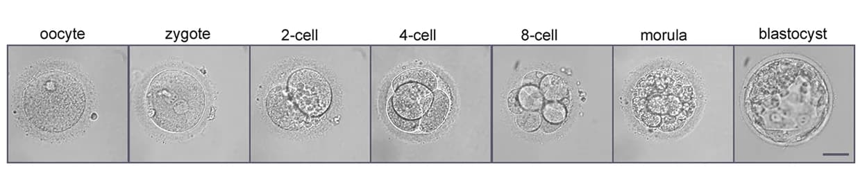 Open access visualization of Microscopy, Microscopy Images, Human Oocyte, Embryos, Zygote