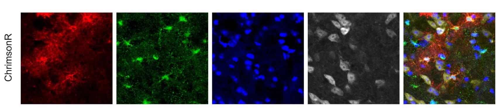 Open access visualization of Microscopy, GCaMP expression, BF Astrocytes, Immunohistochemistry