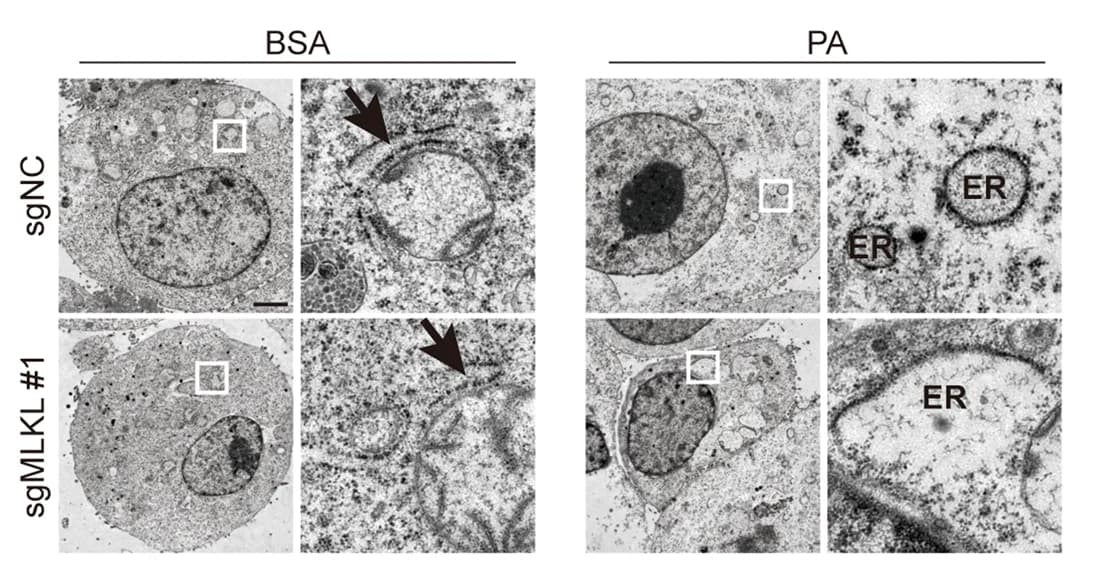 Open access visualization of Microscopy, Transmission electron microscopy, ER, MLKL-KO Hepa 1-6-luc cells, Control cells