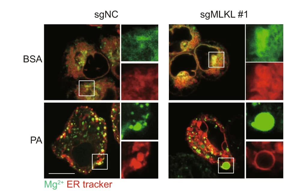 Open access visualization of Microscopy, ER, Mg2+ signaling, MLKL-KO Hepa 1-6 Cells, Control Cells