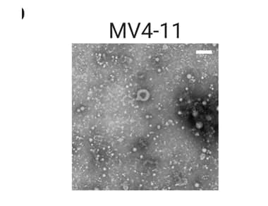 Open access visualization of Microscopy, TEM, sEVs, MV4-11 cells, Negative staining