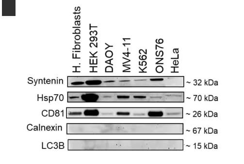 Open access visualization of Gel, Western blot, CD81, HSP70, Syntenin