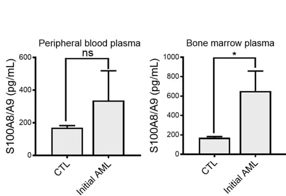 Open access visualization of Bar Plot, Error Bars, Clustered, S100A8/A9, sEVs