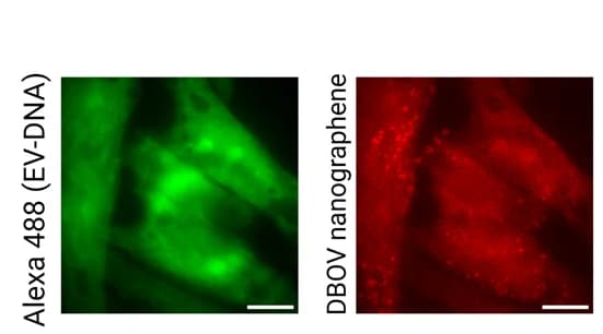Open access visualization of Microscopy, Polymersome, BM-MSCs, EV-DNA