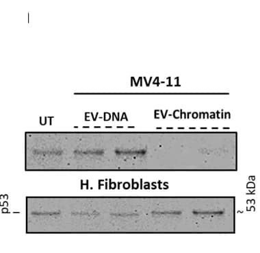 Open access visualization of Gel, sEVs, MV4-11 cells, Fibroblast, p21