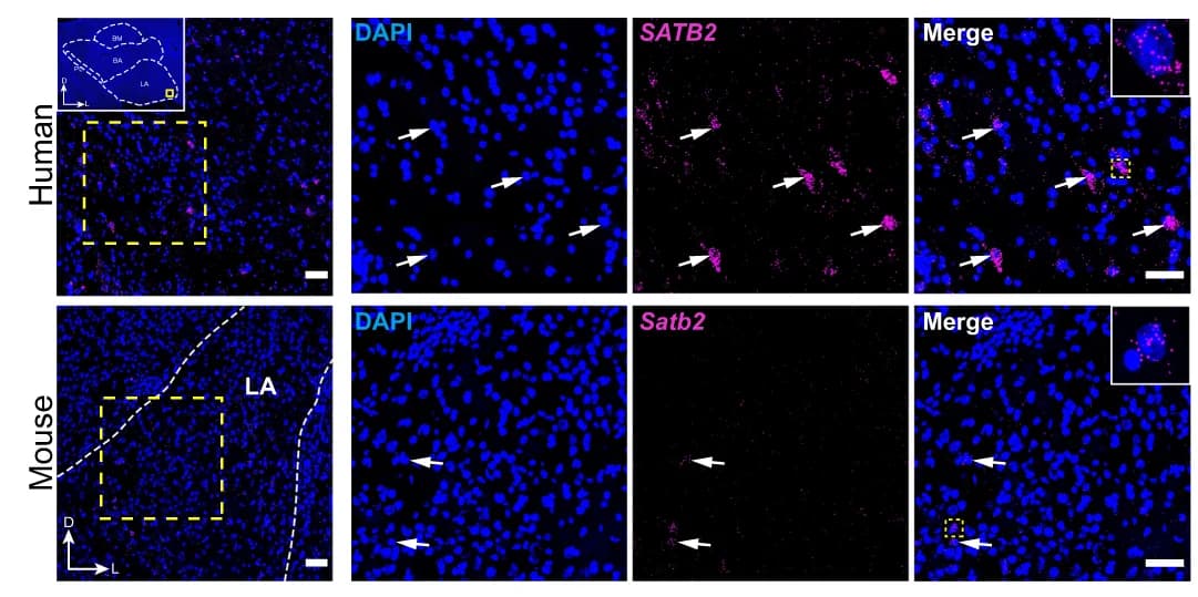 Open access visualization of Microscopy, mFISH, SATB2, Human, Mouse