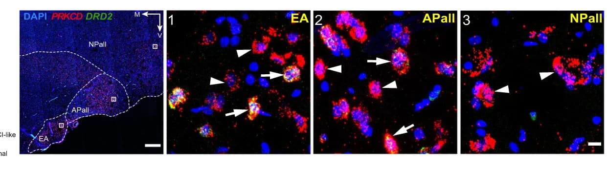 Open access visualization of Microscopy, mFISH Analysis, CEA Marker Genes, PRKCD, DRD2